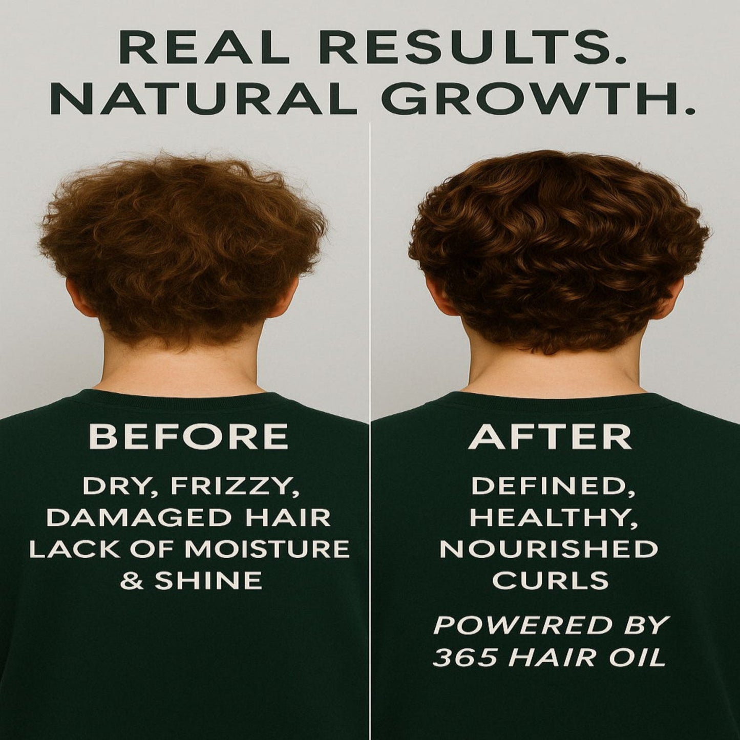 Hair Growth Kit